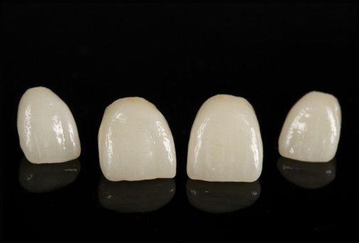 Porcelaine CAD/CAM fondue dans le pont en zirconium pour la restauration de l'aspect naturel