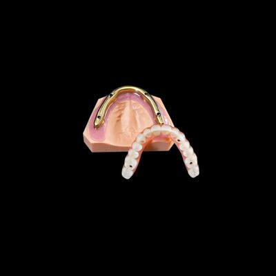 Pont de zirconium dentaire personnalisable sur une barre d'implant fraisée