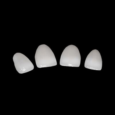 Porcelaine CAD/CAM fondue dans le pont en zirconium pour la restauration de l'aspect naturel