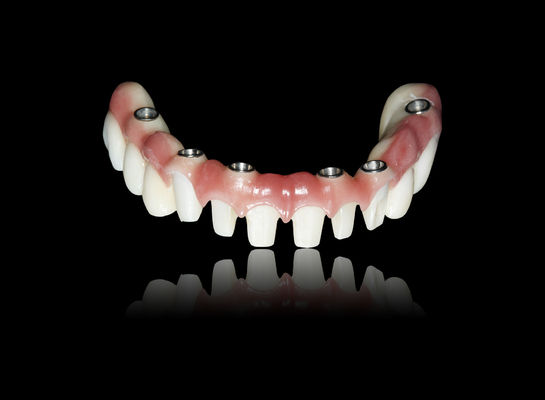 acheter Toutes sur X Implantation de pont de zirconium Implantation de pont de couronne Apparence naturelle online manufacture