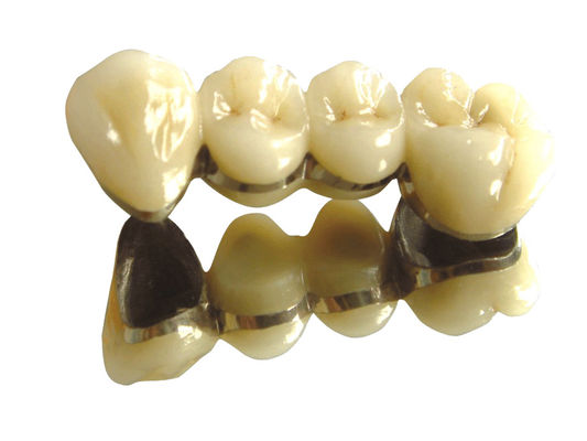 acheter Couronne et pont en alliage blanc noble Couronne et pont en métal précieux online manufacture