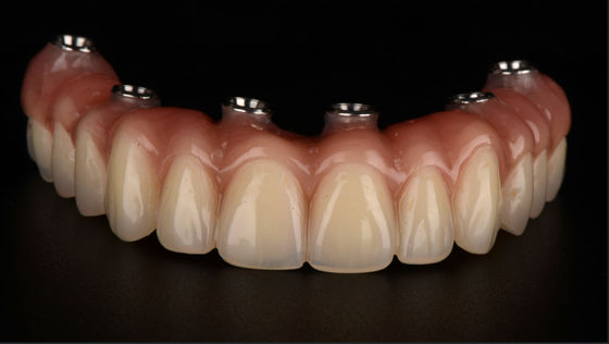 acheter Tout sur X Prothèses dentaires à support d'implant Puits de titane Approbation FDA online manufacture