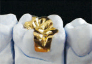 acheter Excellent or dentaire en forme d'incrustations et en forme d'incrustations en or CE et FDA online manufacture
