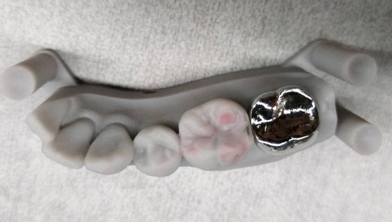 acheter Implantation de couronne en métal non précieux PFM couronne et pont professionnel online manufacture