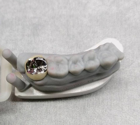 acheter Couronne métallique en alliage semi-précieux et dent de pont Couronne temporaire online manufacture