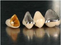 acheter Couronne de nobles alliages précieux et pont couronne provisoire jaune online manufacture