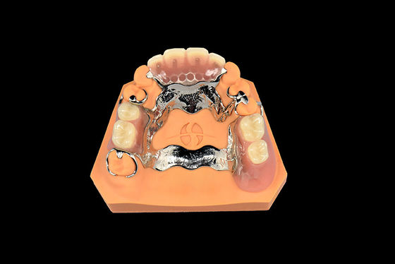 acheter Implants dentaires Prothèses dentaires amovibles Prothèses partielles en métal online manufacture