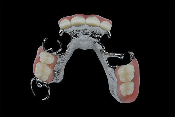 acheter Prothèses dentaires amovibles personnalisables cadre en titane cadre en métal dentaire online manufacture