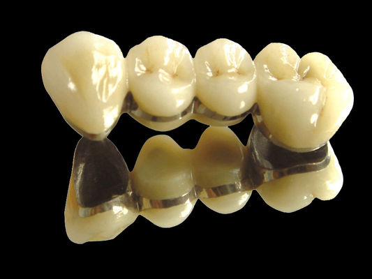acheter Implant de pont de métal précieux pont de couronne résistant à l'usure personnalisé online manufacture
