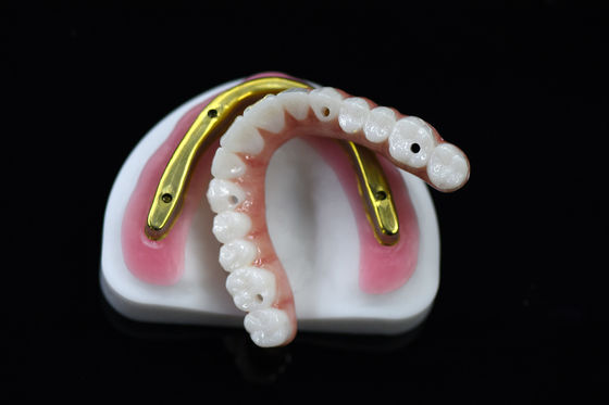 acheter Pont de zirconium dentaire personnalisable sur une barre d'implant fraisée online manufacture