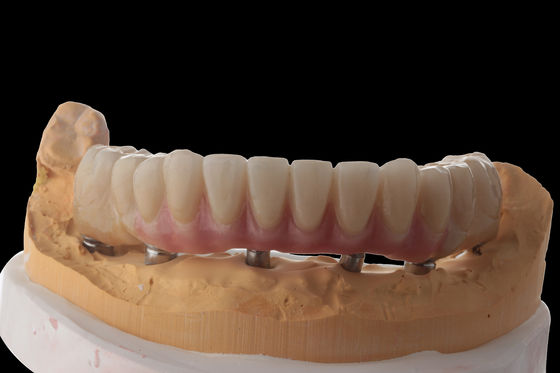 acheter Personnaliser les implants dentaires hybrides Prothèse hybride avec barre de titane online manufacture