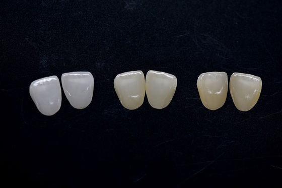 acheter Veneur de zirconium hautement esthétique Veneurs de zirconium Emax durables online manufacture