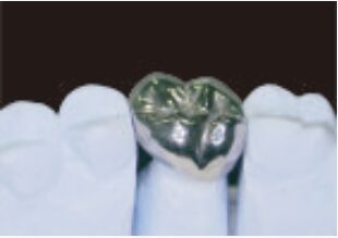 acheter Couronne en métal et pont de haute précision Couronne temporaire en argent online manufacture