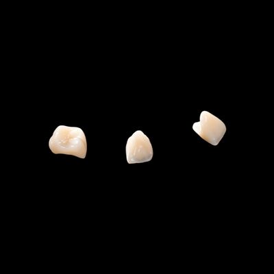 acheter Porcelaine CAD/CAM fondue dans le pont en zirconium pour la restauration de l'aspect naturel online manufacture