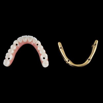 acheter Personnaliser les implants dentaires hybrides Prothèse hybride avec barre de titane online manufacture