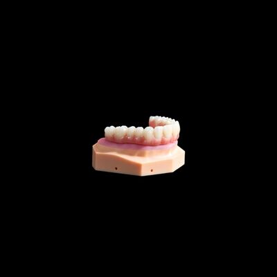 acheter Implantation de couronne de base en titane couronne / pont en composite online manufacture