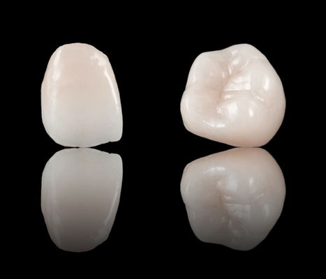 Haute esthétique couronne dentaire à contour complet pont en zirconium CE et approbation FDA