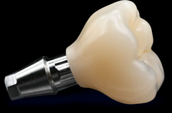 CAD / CAM Implantation couronne pont haute esthétique couronne de zirconium
