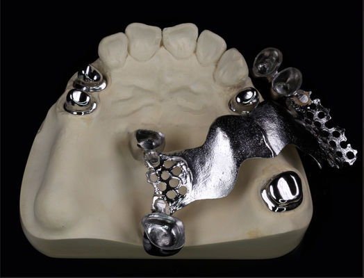 Téléscope couronne métallique et pont pour dentisterie et orthodontie
