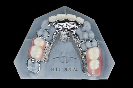 Cadre métallique en titane Prothèse amovible Fausses dents sur mesure