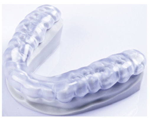 Appareil d'orthodontie imprimé 3D à attelle douce dentaire transparente