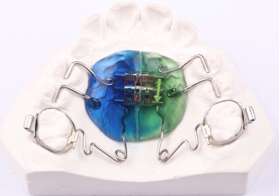 Appareil de pendule de la FDA Orthodontie Appareil de pendule orthopédique personnalisable