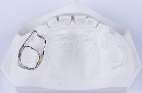 Retenant d'espace dentaire personnalisable pour les dents Retenant pour fixer l'écart