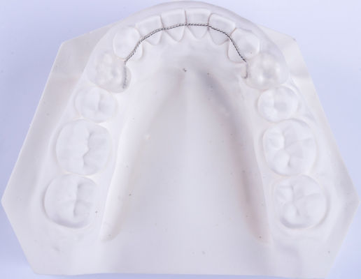 Retenant de fil de langue non amovible Retenant d'orthodontie pour redresser les dents