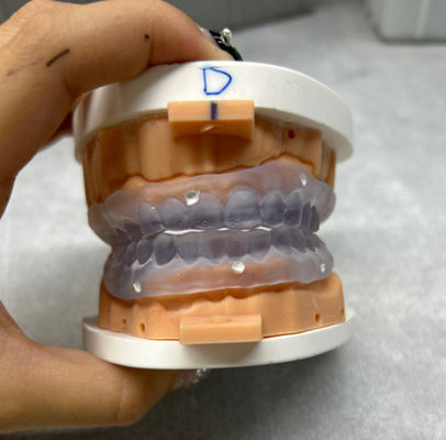 Des prothèses dentaires imprimées en 3D personnalisables Essayez une prothèse complète numérique
