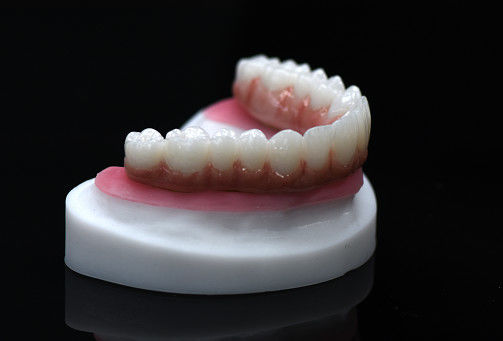 Pont hybride en zirconium à pleine voûte en zirconium à couronne personnalisé