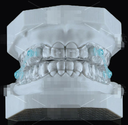Appareil d'orthodontie à silos Erkodent transparent