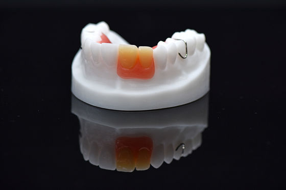 Prothèse surdentitaire amovible à nageoires acryliques personnalisée Prothèse acrylique amovible