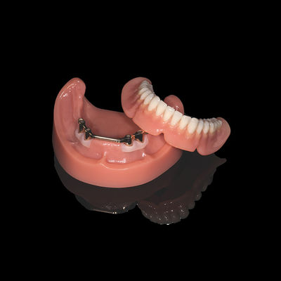 Prothèses dentaires amovibles en titane rose avec finition en acrylique