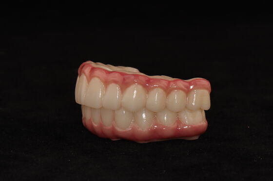 Tout sur le pont X-Zirconia